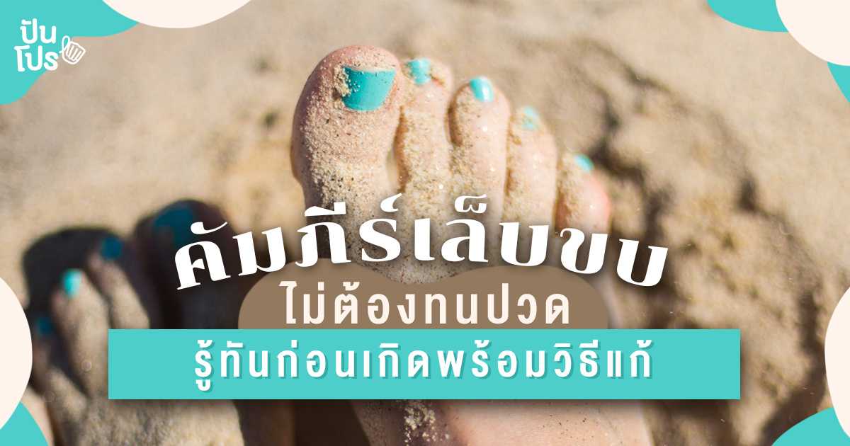 เล็บขบแก้ไม่ยาก รักษาเล็บขบด้วยวิถีธรรมชาติ ไม่ต้องรอจนเล็บขบหนอง! เล็บขบแก้ไม่ยาก รักษาเล็บขบด้วยวิถีธรรมชาติ ไม่ต้องรอจนเล็บขบหนอง!
