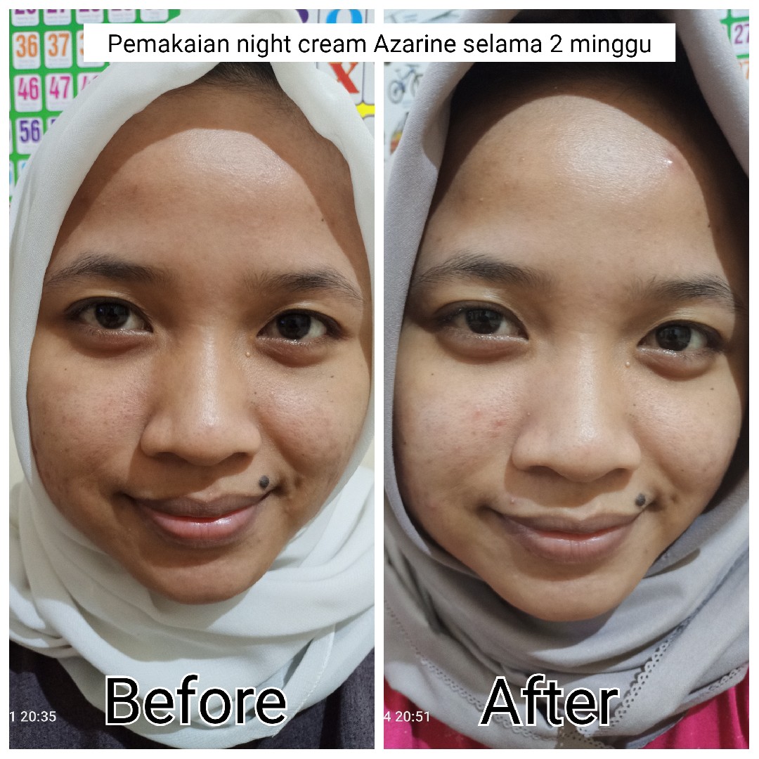 azarine night moisturizer