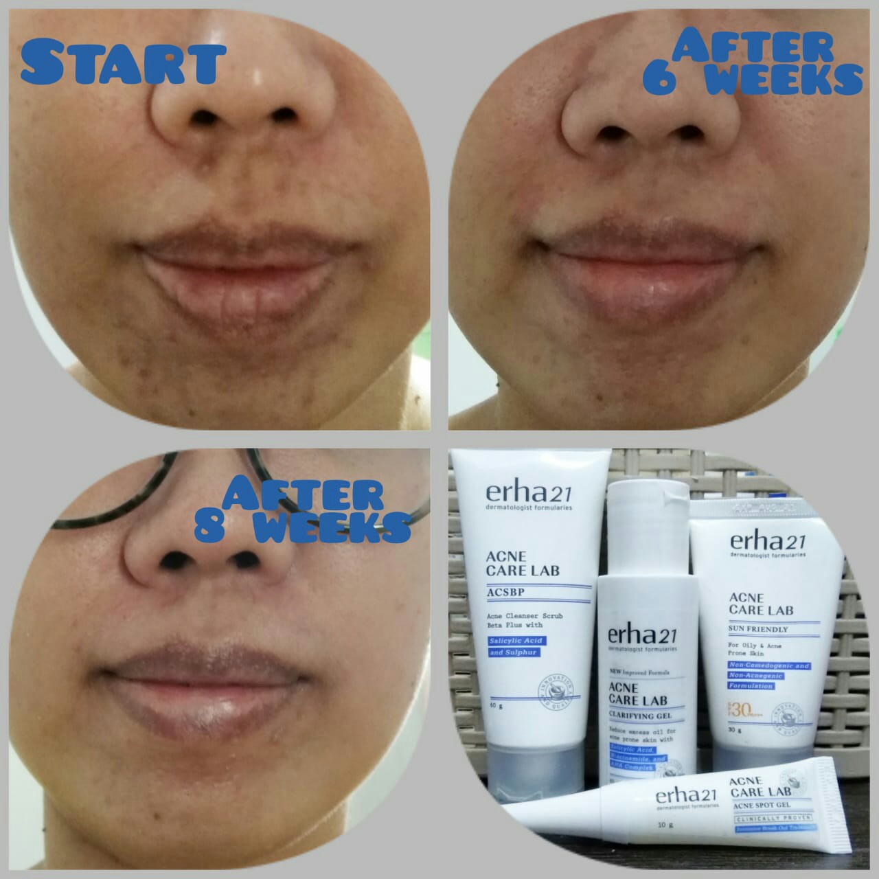 female daily erha skin care