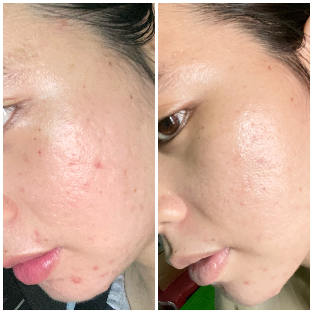 benton aloe bha skin toner female daily