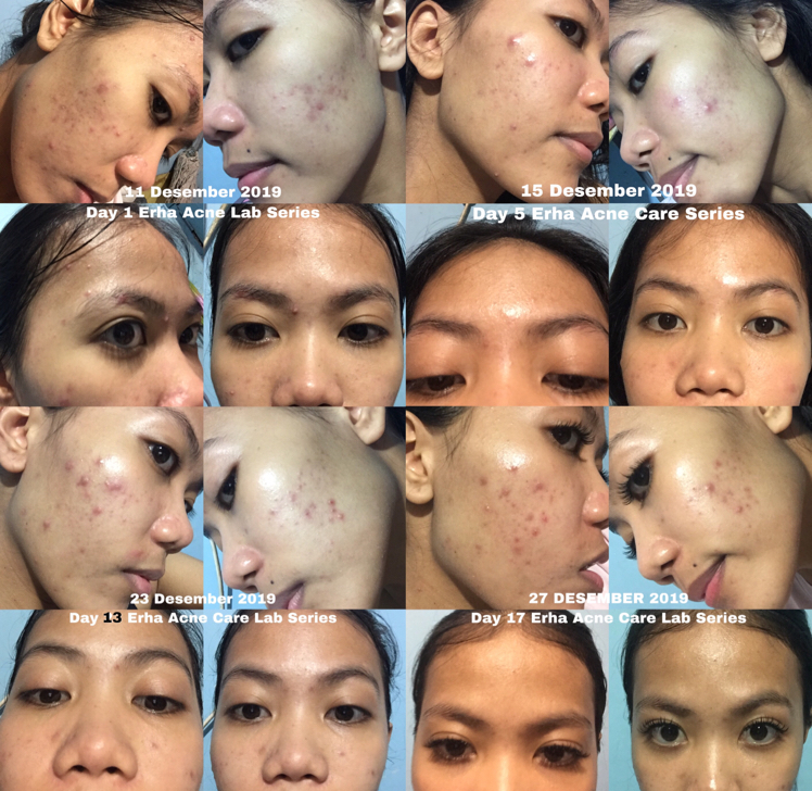 female daily erha skin care