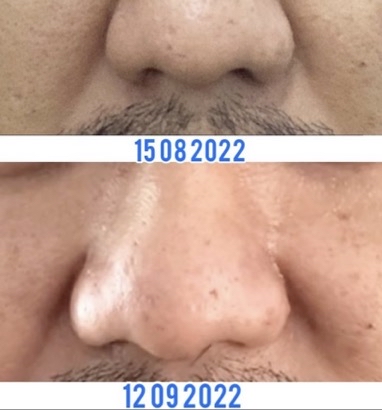 Miwaji Hyalu Serum Veil 221124 561 2