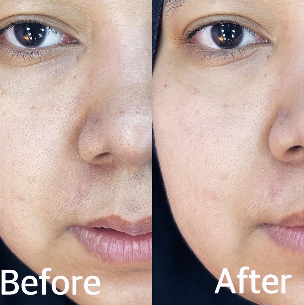 Wardah Renew You AntiAging Eye Cream Beauty Review