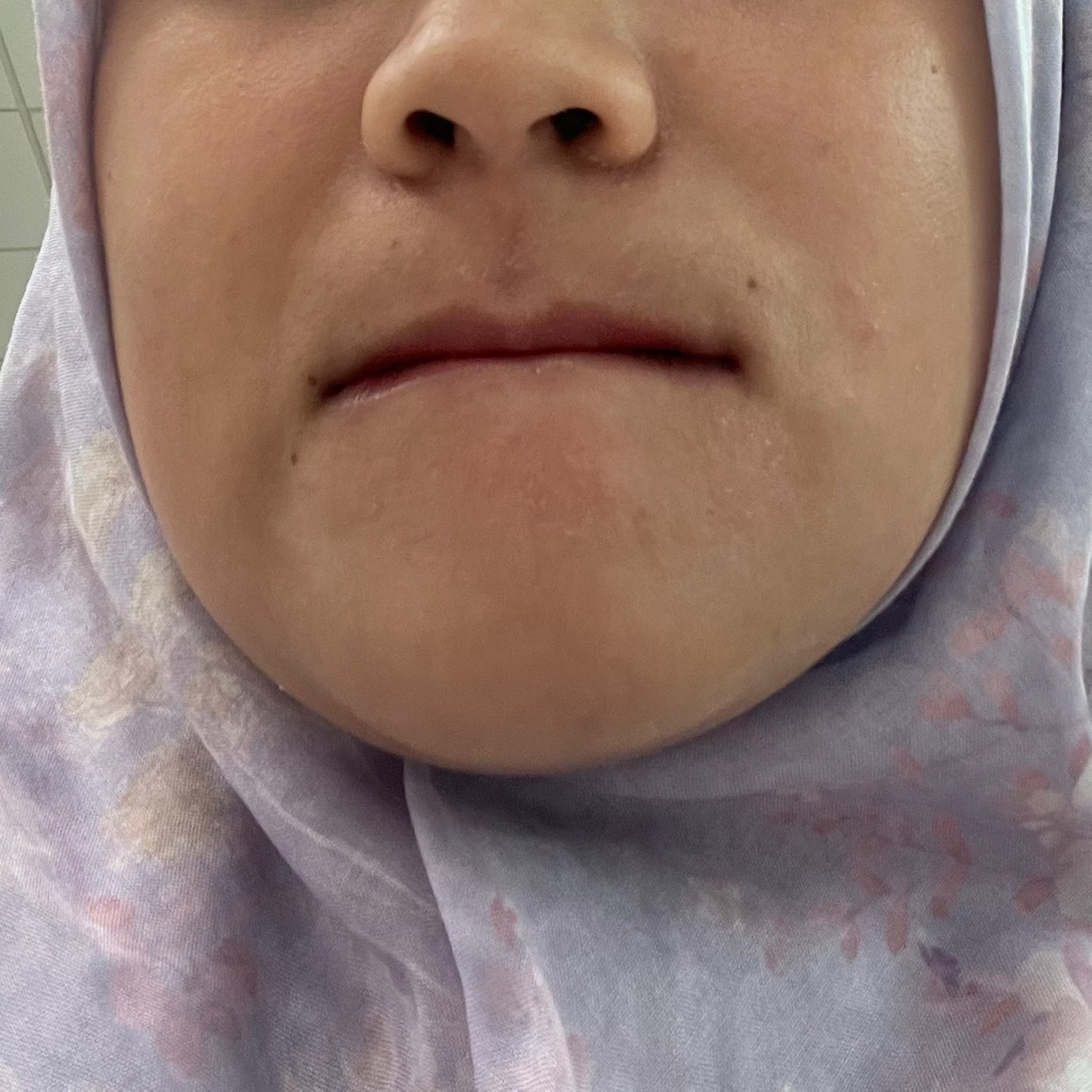 Ceramide Ato Concentrate Moisturizer Cream imgfdn-fec6646d-1fab-49d7-8ecf-89c3bc13e8e4