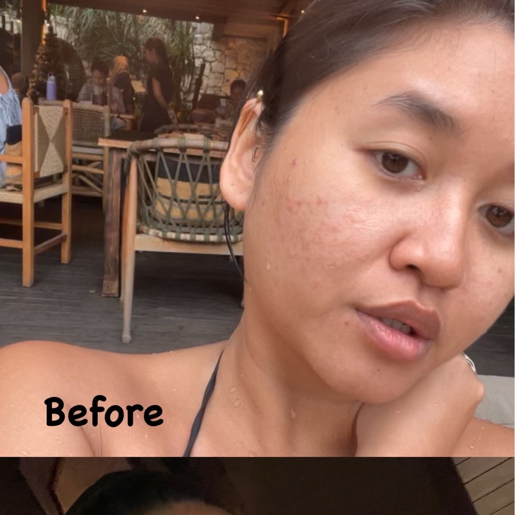 Ultimate Vibrant Skin imgfdn-a0da806f-28b3-445c-a1d1-ee1bc3e4b0b8