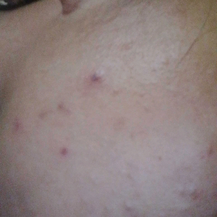 Tremella Vita B5 Sensitive Calming Moisturizer imgfdn-f7c3b9ed-7375-40e0-aec0-04127d365f61