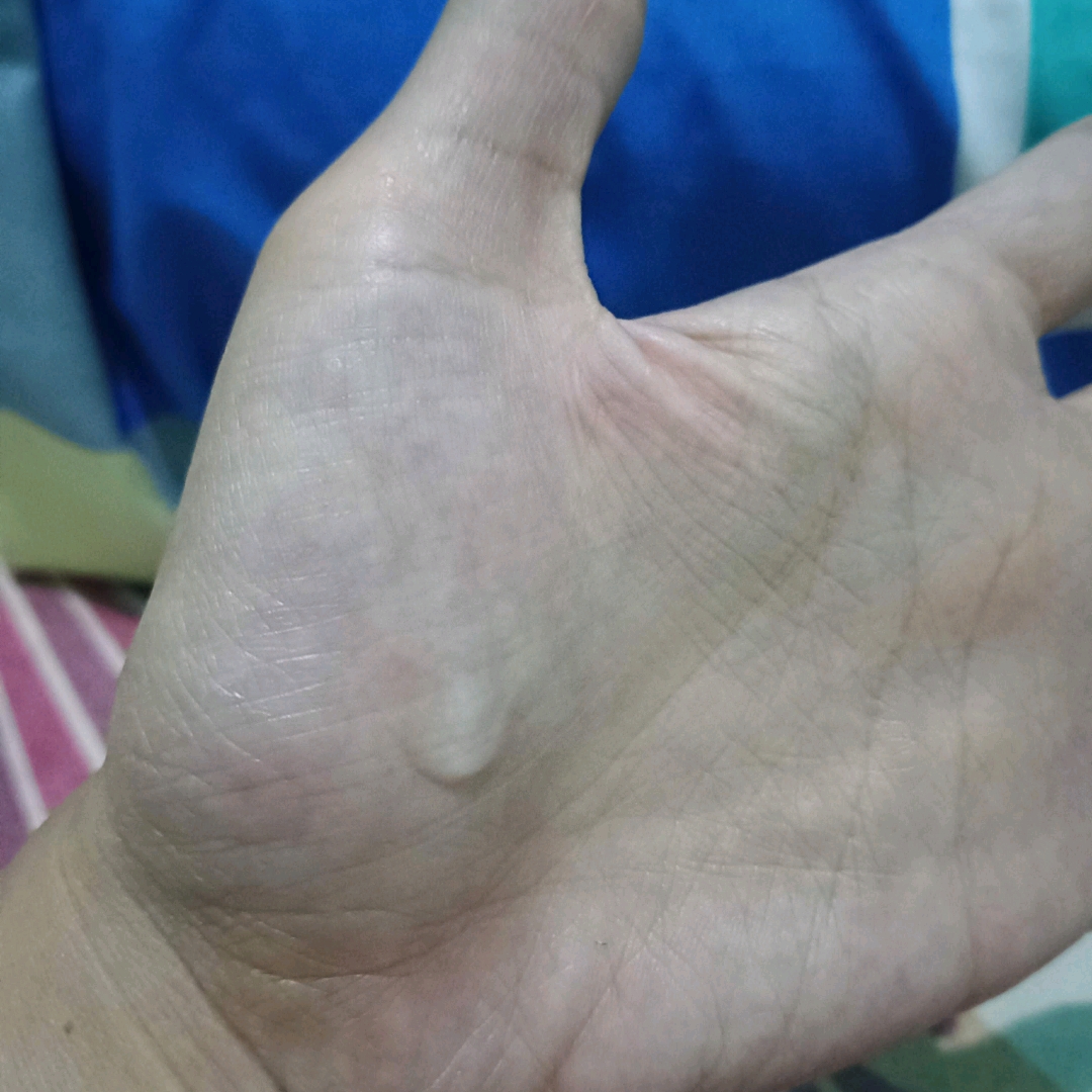 Lip Tint Eraser imgfdn-9ed67063-c340-4219-95bd-982ce7ee71a6