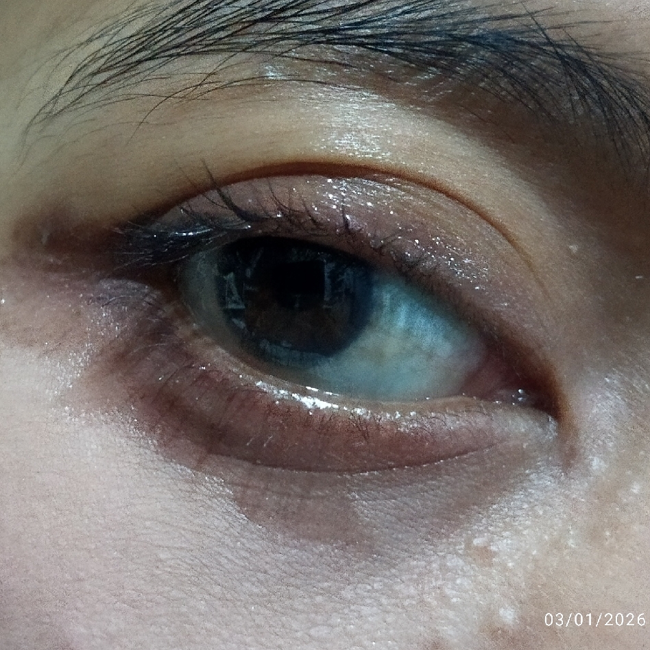 Mascara Remover imgfdn-dc0919c0-e609-45f6-b2cb-4bd6f16e85ed