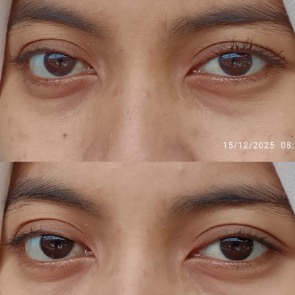 MaxCara Volumizing & Lengthening imgfdn-34799eee-a17b-4068-b336-55cb436c0a3b