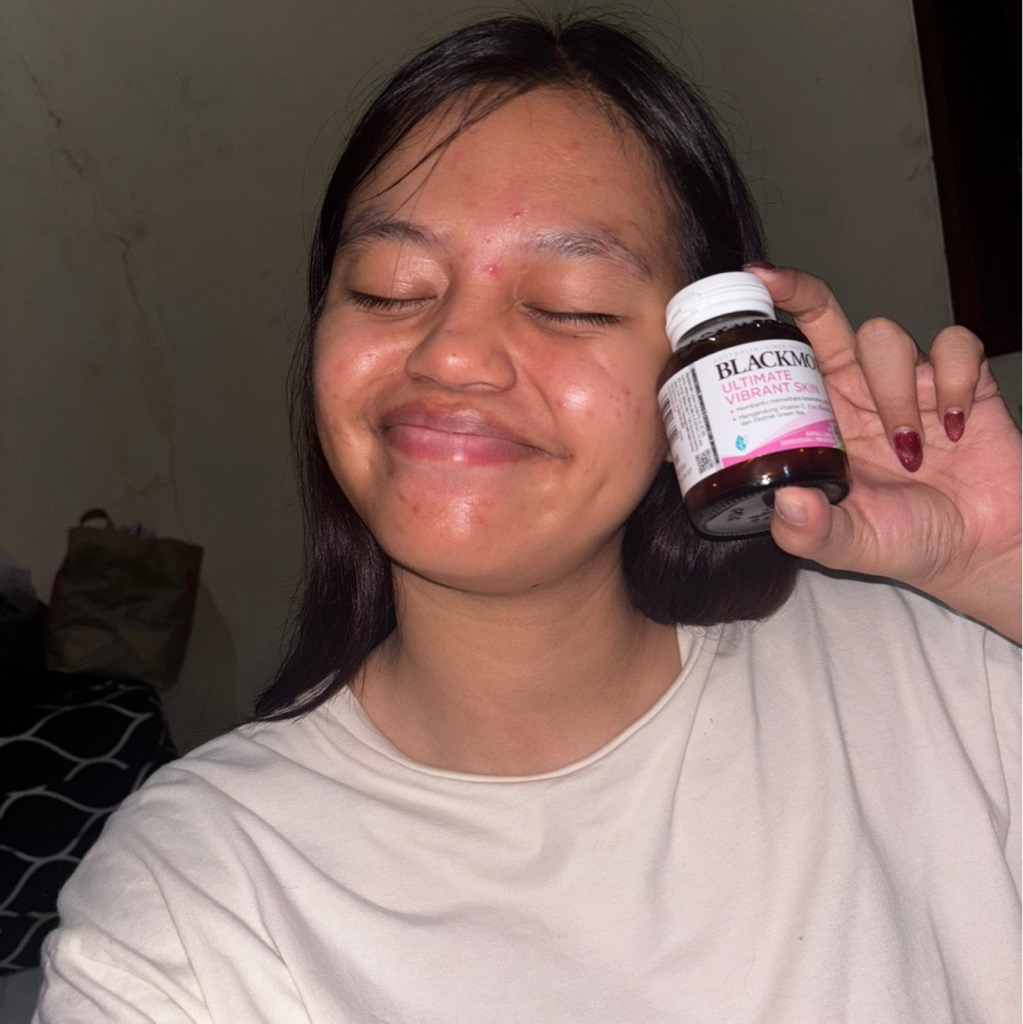 Ultimate Vibrant Skin imgfdn-0ee6417f-004a-42af-aba3-01d6b3afec48