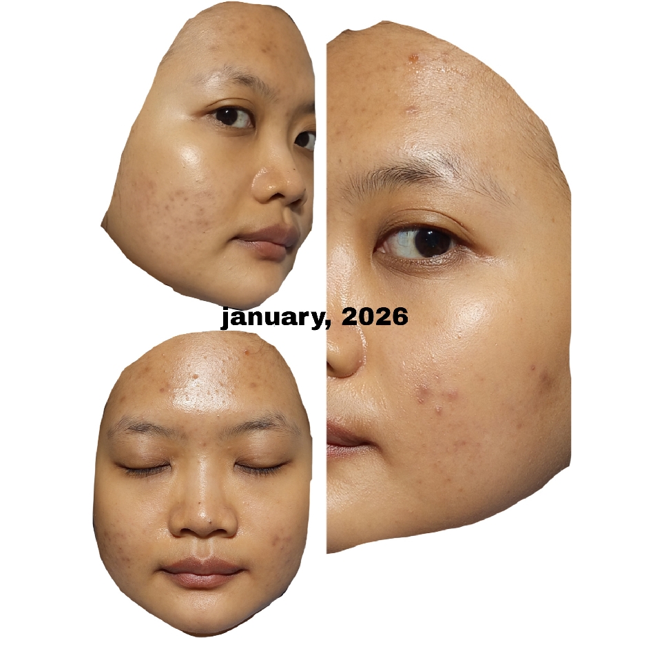 Ultimate Vibrant Skin imgfdn-a45e047e-5a45-4a85-8c77-42c29cee8492