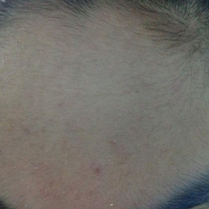 SPF50 PA++++ Acne & Oil Control imgfdn-2773d2fe-22f1-4444-988f-87632d800355