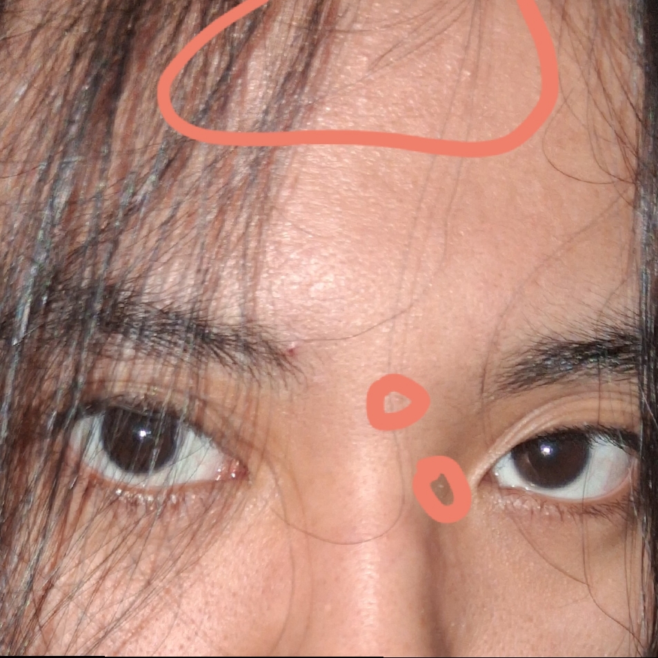 Bye Bye Blackheads 30 Days Miracle Green Tea Tox imgfdn-86392d29-2f76-4178-81ed-227dec8c8152