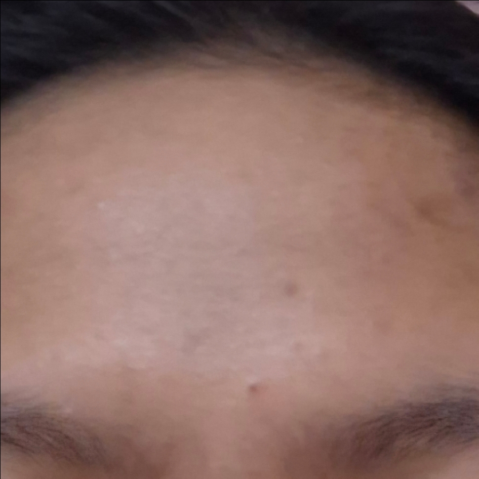 Niacinamide Barrier Serum imgfdn-bb2ddd60-906e-43b5-a30e-4b01b0f53b3c