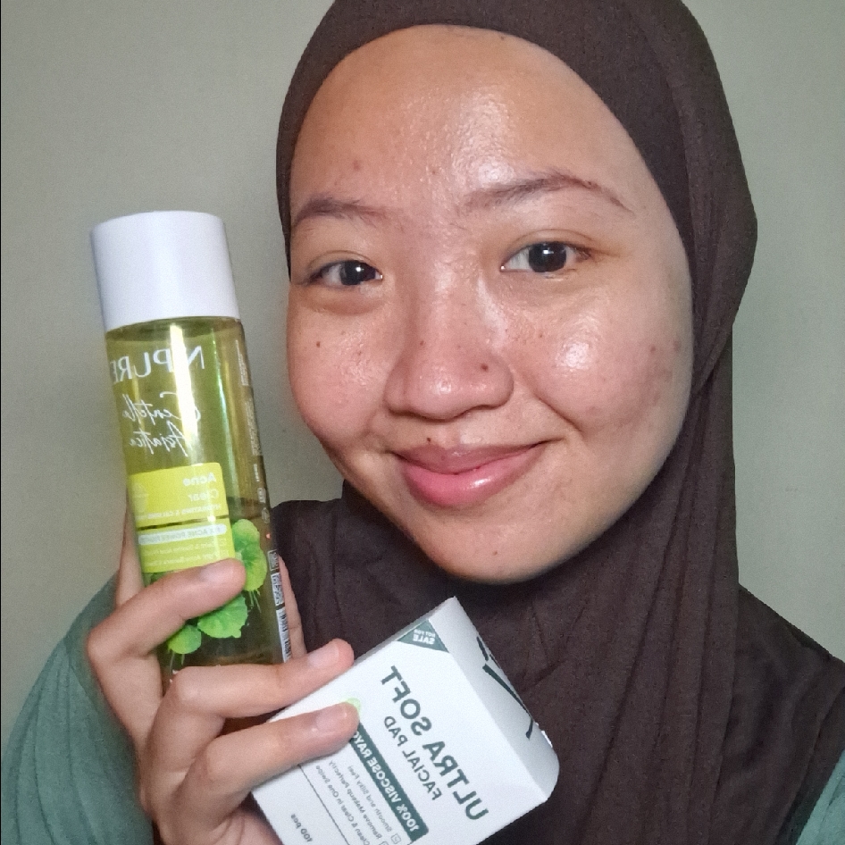 Centella Asiatica Acne Clear Hydrating & Calming Toner imgfdn-89a525d1-2907-401b-b35c-8d889397b8dd