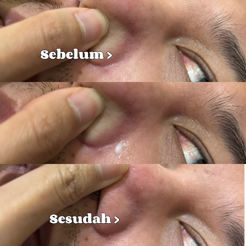 Derma Sensitive Skin Rescue Moisturizer imgfdn-0d565c2c-c25a-4268-b5df-32f08001e6b8