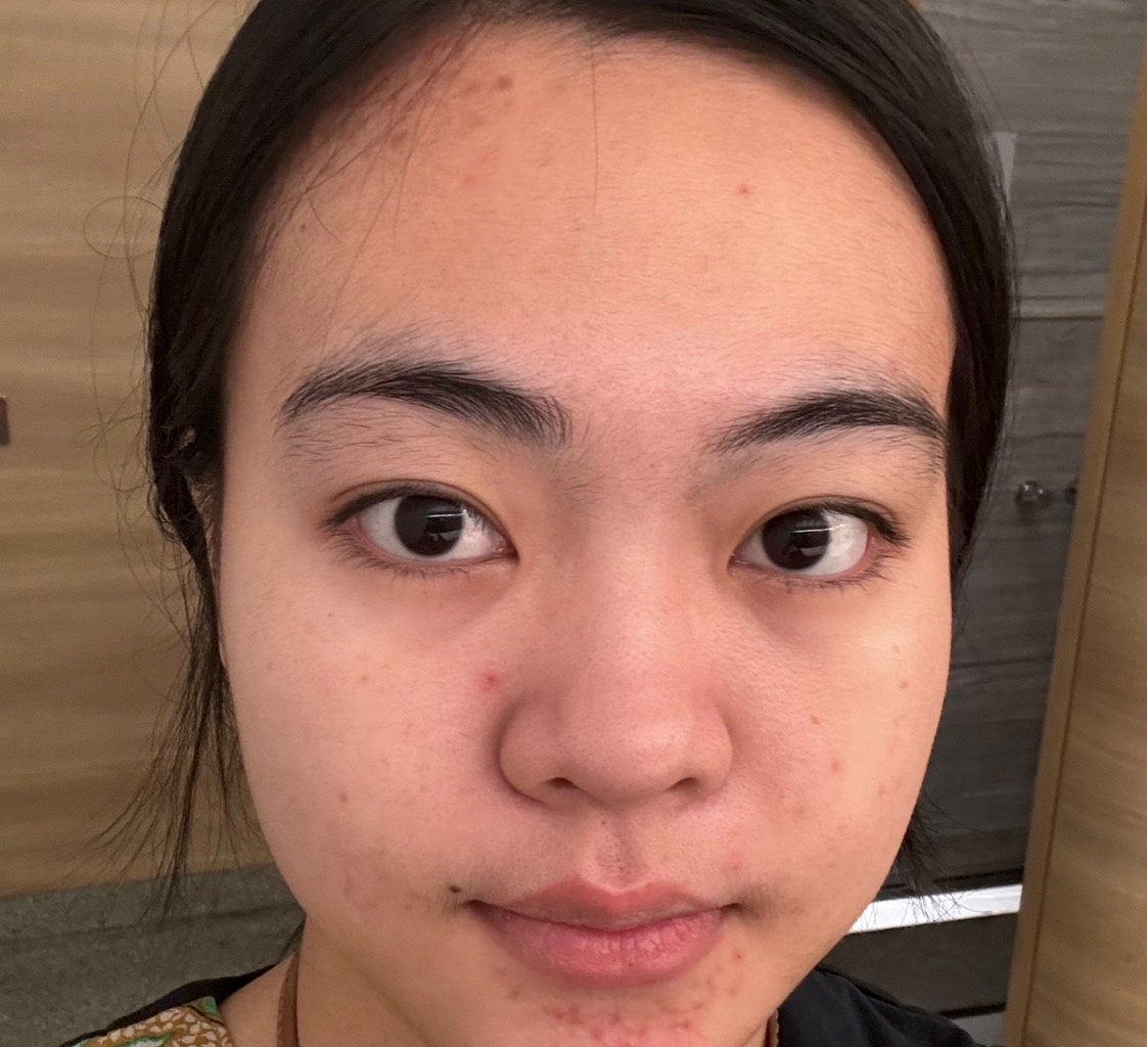 Forever Foundation - 2N imgfdn-ca039fc8-571e-4912-89b9-b02cf7657dbe