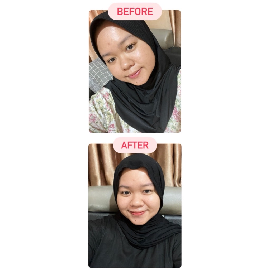 Ultimate Vibrant Skin imgfdn-adda8b9c-b63b-43e2-bf48-e1ad892d7c89