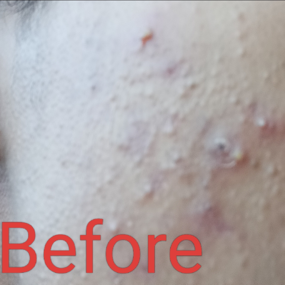 BiomeRepair™ Barrier Revive Cream imgfdn-47fc7042-63bb-4e88-b2fe-ba2dc045aede