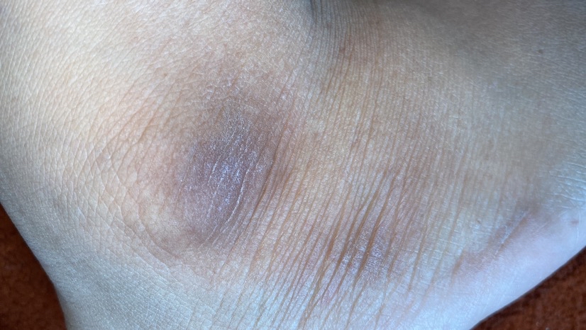 No Bump Lotion imgfdn-4a830ae0-75b1-444e-8458-7206bb4bdb6b