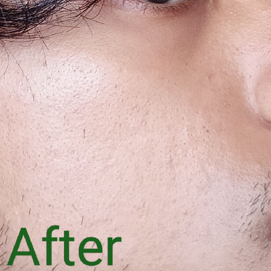 BiomeRepair™ Barrier Revive Cream imgfdn-dd4073e8-03f4-48a1-b45b-36b0e8466243