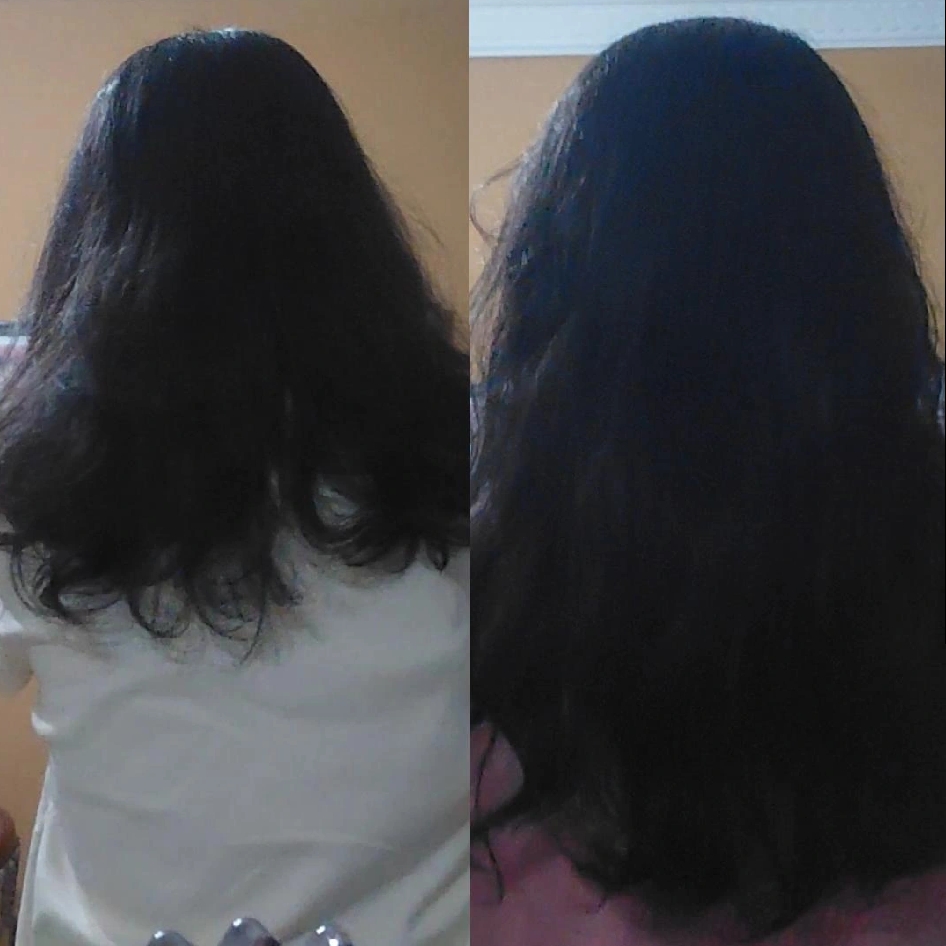 Rosemary Hair Growth Oil imgfdn-68b97d9d-c649-43d6-bf71-37acca609e12