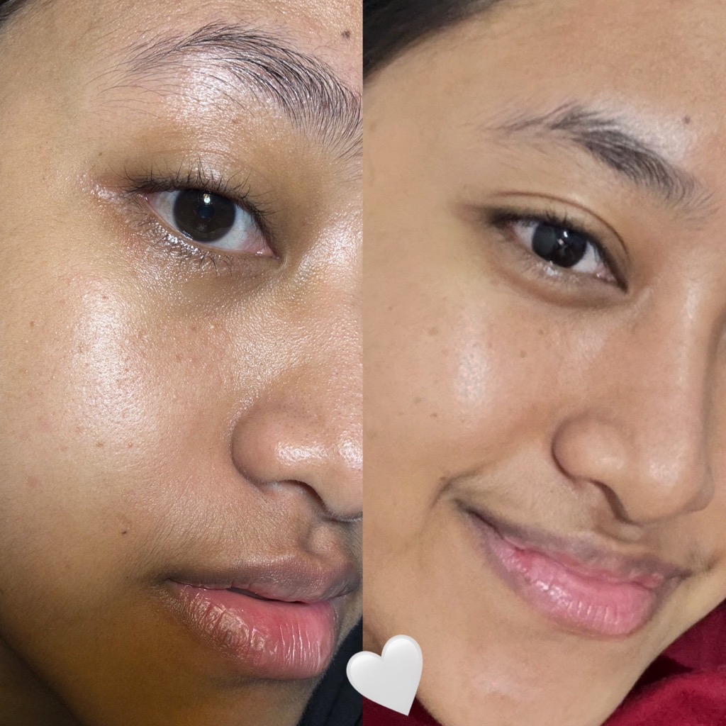Recombinant Collagen Gel Moisturizer imgfdn-26e87867-65a2-4639-8b52-18017c233412