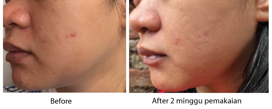 Centella Asiatica Tone Brightening Capsule Ampoule imgfdn-0423a840-e7cb-4870-bf8c-fbb2cb220e1e