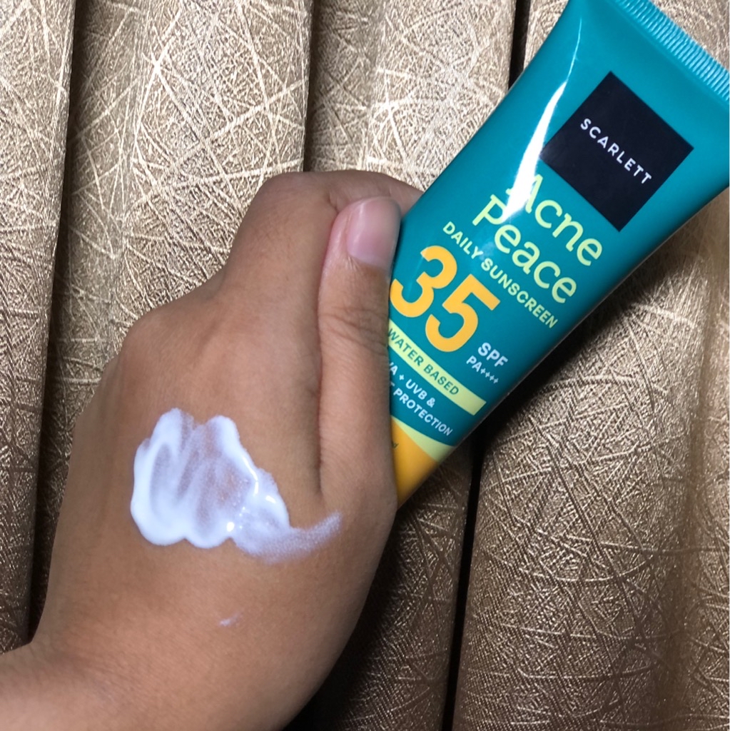 Acne Peace Daily Sunscreen SPF 35 PA++++ imgfdn-4183a11d-8b3d-486f-9d07-62b4285bd43e