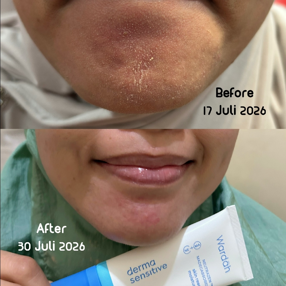 Derma Sensitive Skin Rescue Moisturizer imgfdn-09547c99-b806-4bb9-adec-97c1e957de3f