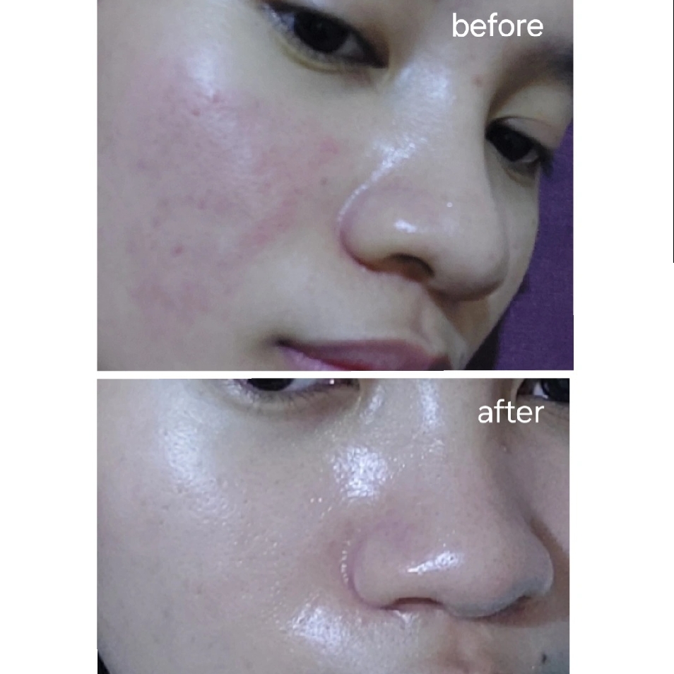 Recombinant Collagen Gel Moisturizer imgfdn-b7069159-dcc3-4f95-8d95-643830ca1b55