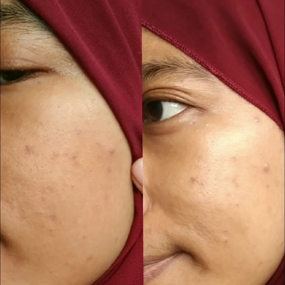 HPR Retinal Serum imgfdn-f5e97093-82eb-4b14-8075-80b8da33b14c