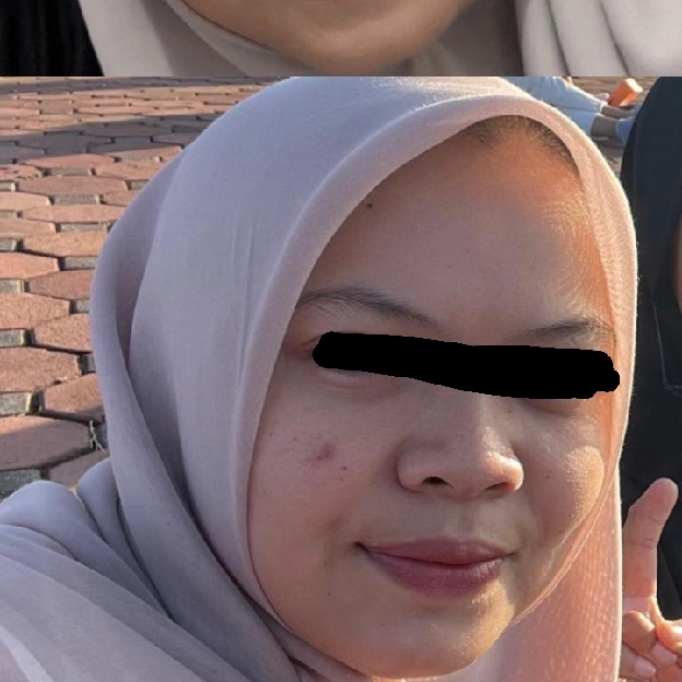 BiomeRepair™ Barrier Revive Cream imgfdn-6e0b746f-1f7f-42d2-a269-802ce79c6c20