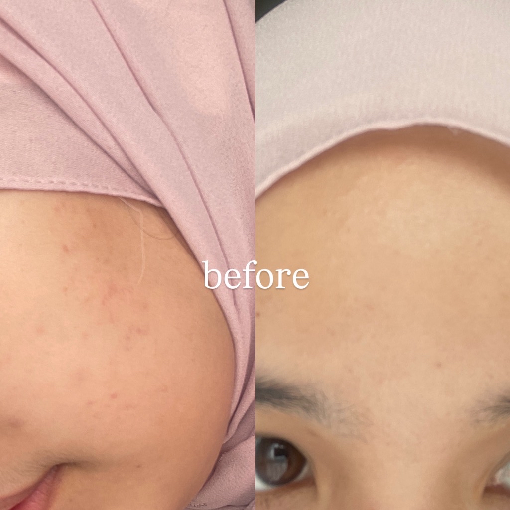 Ultimate Vibrant Skin imgfdn-9bc92a79-be17-4093-86c6-5dccc5298d33