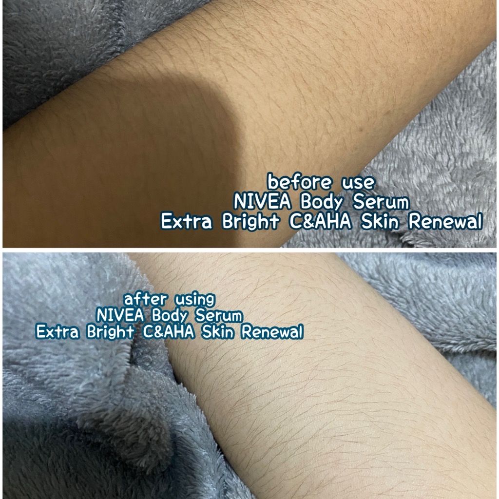 Body Serum Extra Bright Super C+ SPF 50+ PA+++ imgfdn-ce52aaa8-a57a-4072-93ad-d6a6c6035275