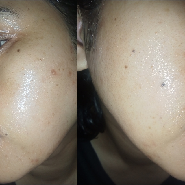 Hyd-rice-ing & Brightening Essence Booster imgfdn-b51b9424-e31d-4df6-8329-be87d0d65458