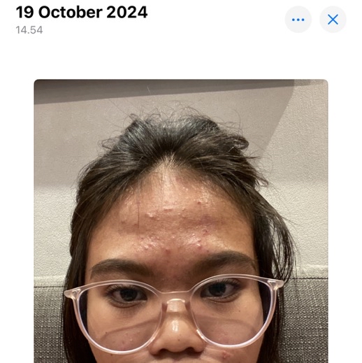 Ultracalm Face Wash imgfdn-85267525-9214-4b58-a78f-88c6df8d00cb