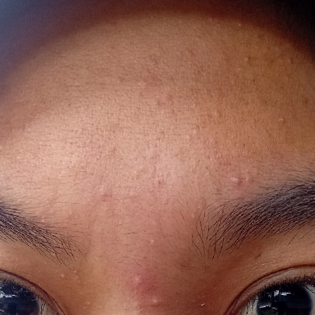 Oil-free Ultra-Moisturizing Lotion (with Birch Sap) imgfdn-0b3e85f9-b152-4110-bd75-d8ee291e326f