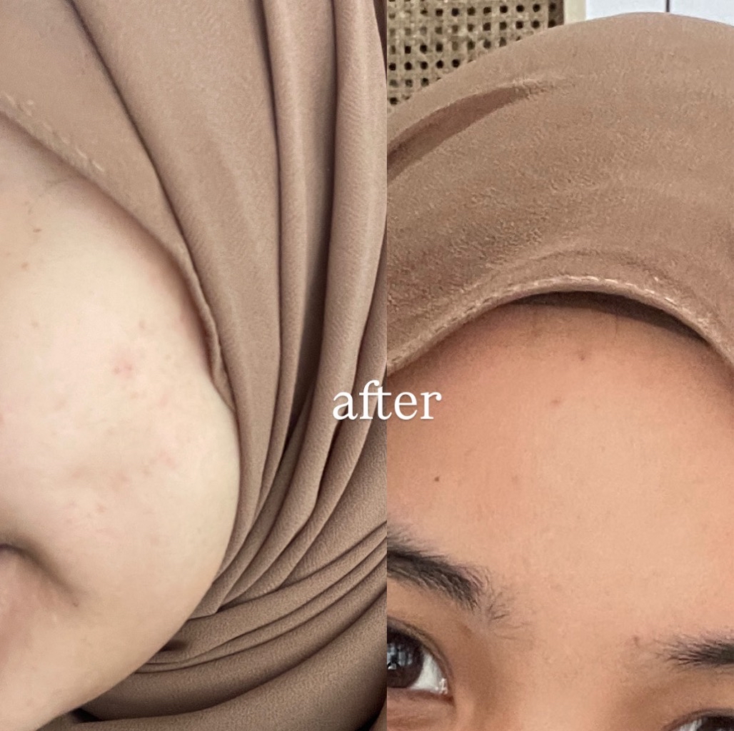 Ultimate Vibrant Skin imgfdn-3d01248a-6cd0-48a1-9936-032500865a49