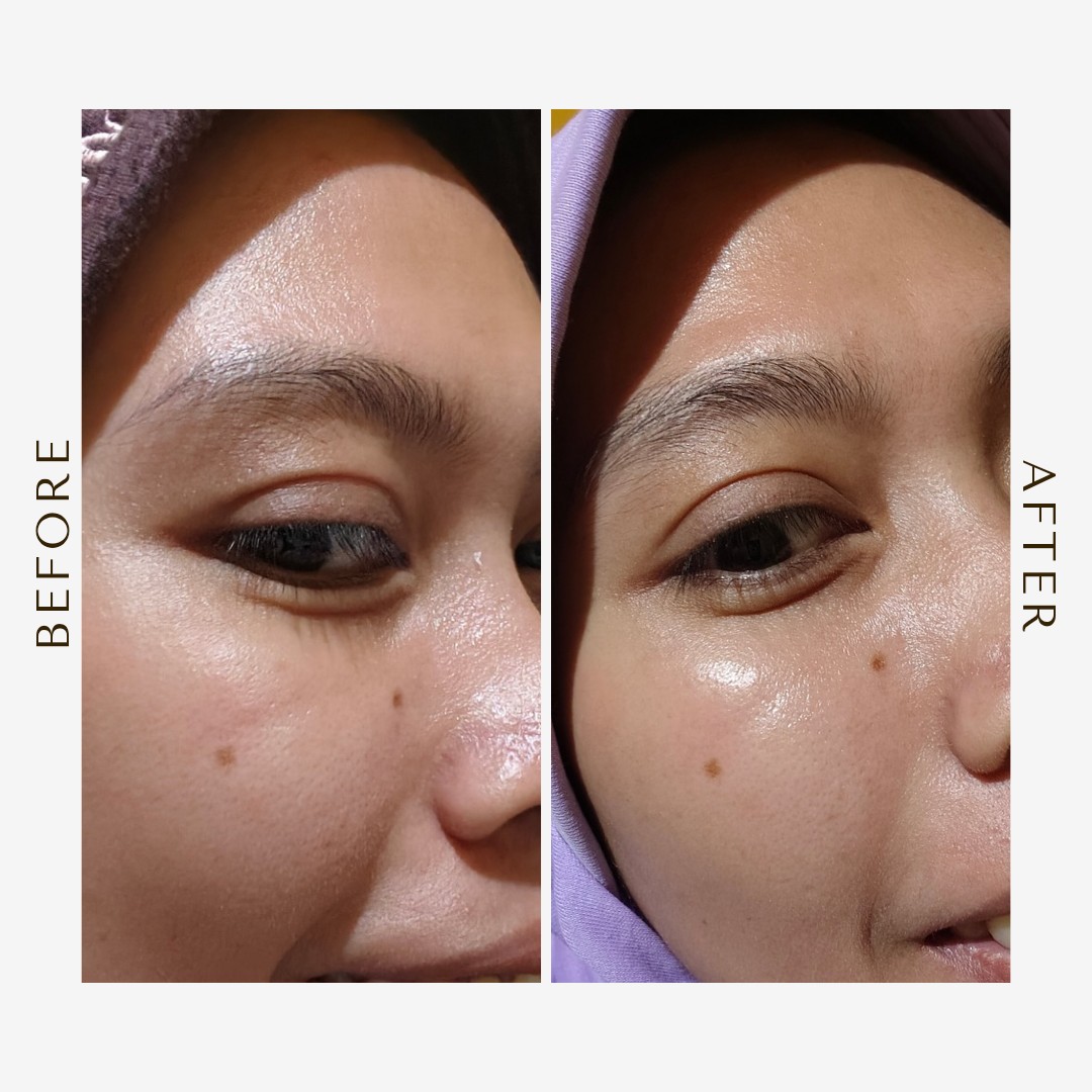 Radiant Resurfacing Retinal Cysteamine Serum imgfdn-1d1bbd7e-ccc1-41ae-a920-27a3a304defe