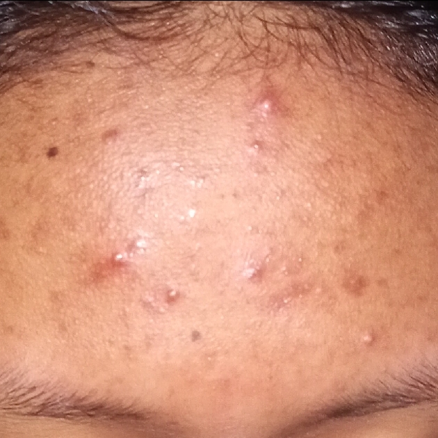 Madagascar Centella Asiatica Ampoule imgfdn-2a127a21-e2c3-4245-afb7-6607bd875218