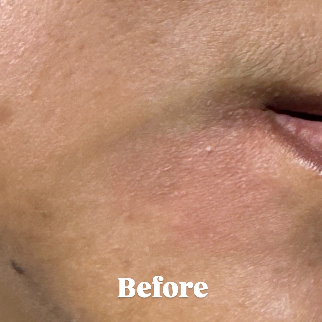 Hydra Miracle Ultra Light Biome Gel imgfdn-c9d6aa05-821c-4bcb-9bee-ea1ac977668b