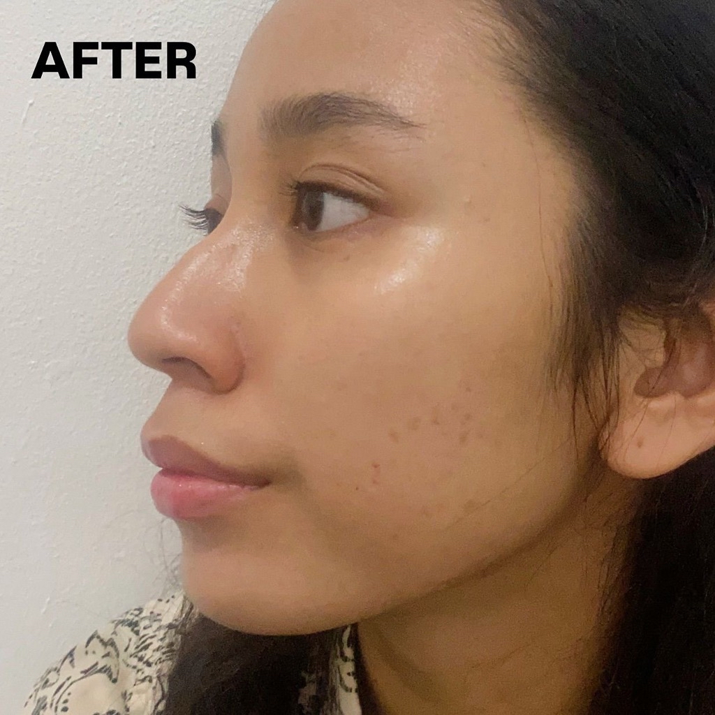 Panthenol Chemical Sunscreen SPF 50 PA++++ imgfdn-3deaf723-1523-45e4-a70f-5249916a8a86