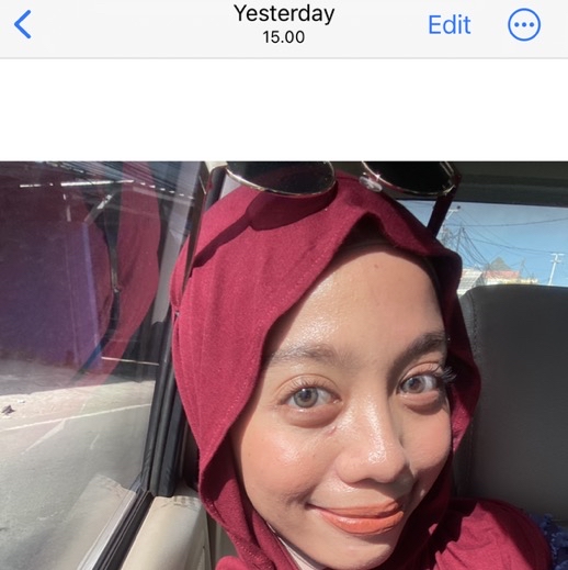 HPR Retinal Serum imgfdn-363c5e49-21dc-48a7-baad-468e15af06ab