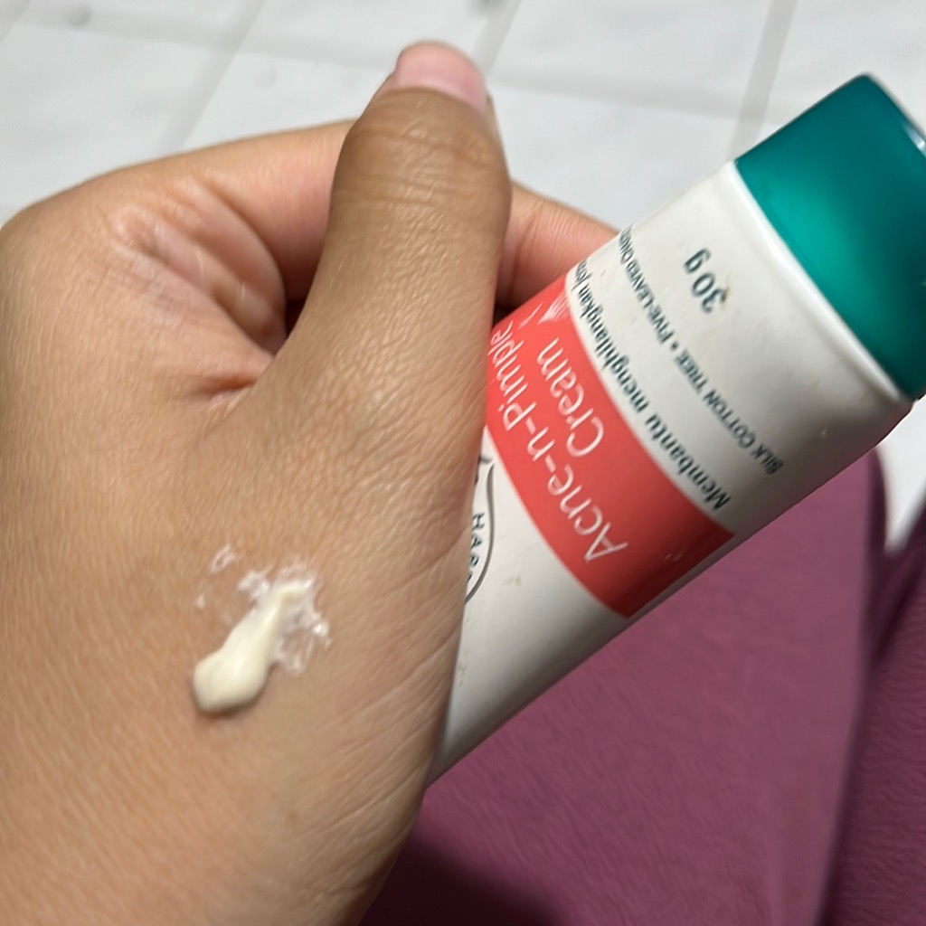 Acne-N-Pimple Cream imgfdn-f300a043-5d9e-42fc-b986-e001e1604e99
