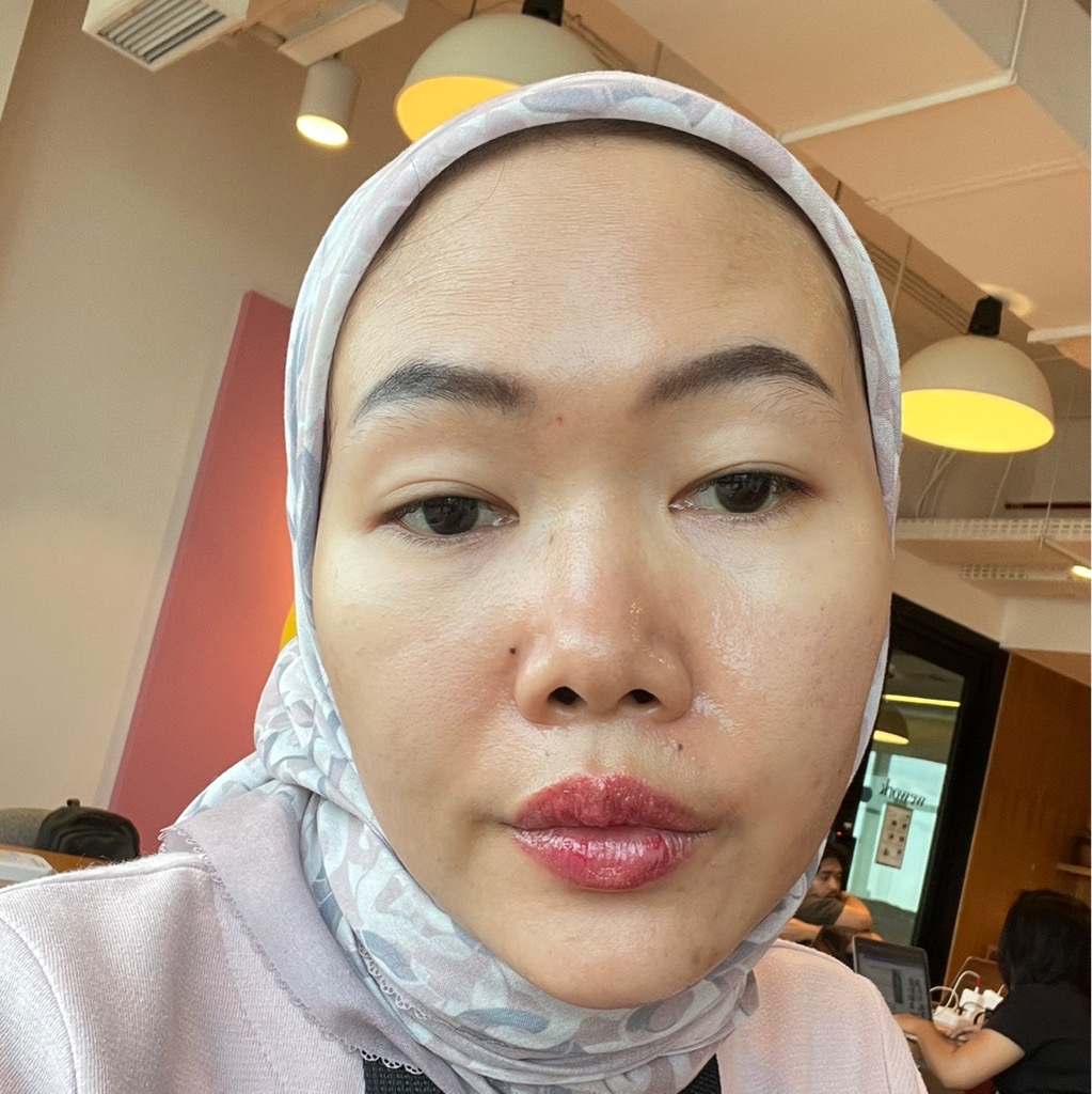 Ultimate Vibrant Skin imgfdn-0af9b737-d045-4cd4-a5bd-16d6948d5782