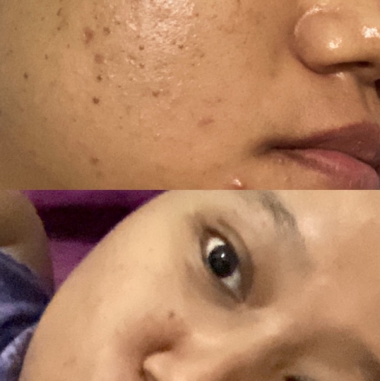 Ultimate Vibrant Skin imgfdn-19da2622-4f54-4917-9fc6-7c312fe445ab