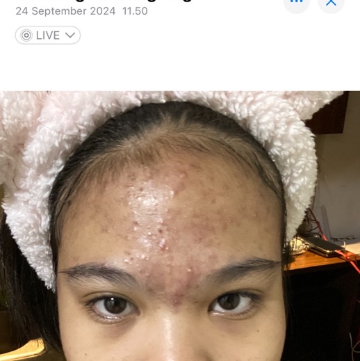 Gentle Acne Facial Wash imgfdn-a0cee95a-7b9c-4b7d-9df7-d3bca2bad73c