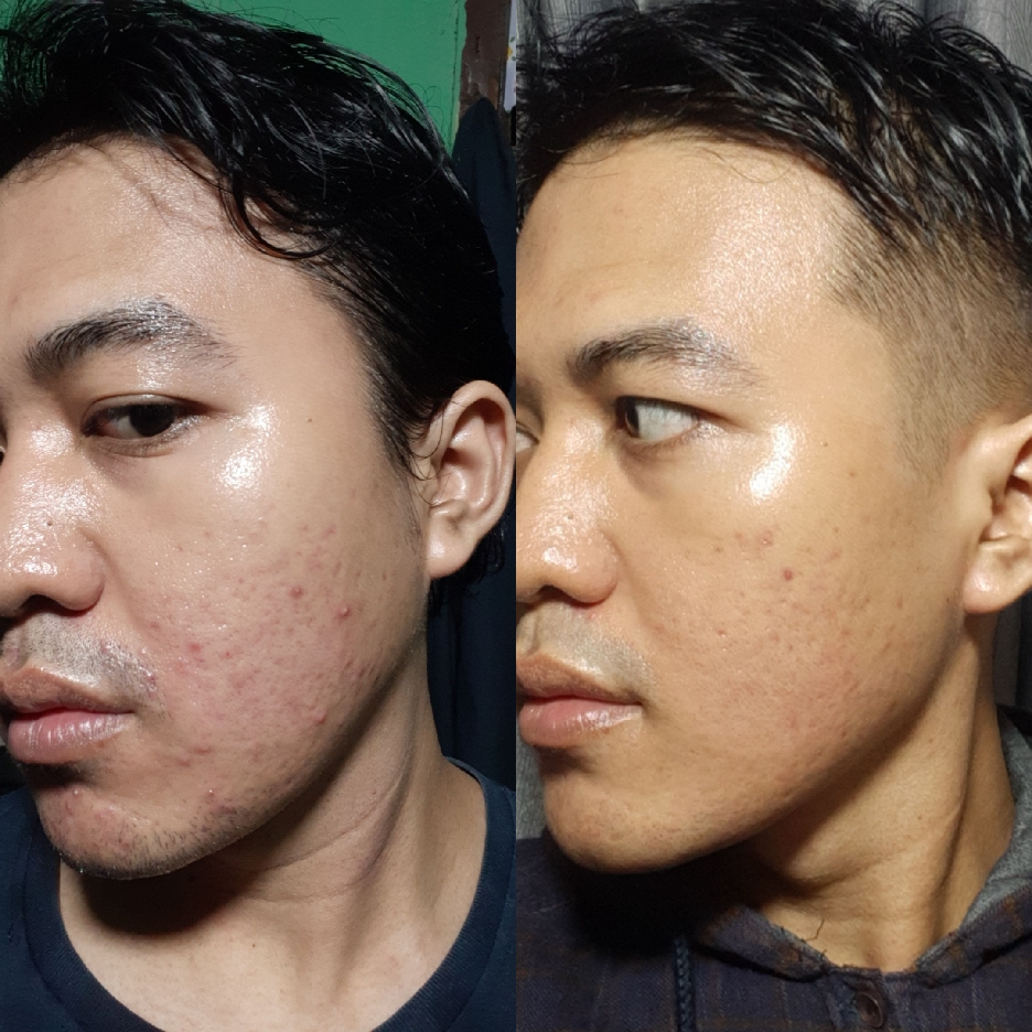 HPR Retinal Serum imgfdn-b64436c4-5551-4d4b-84e0-7e7c83aa0a3e