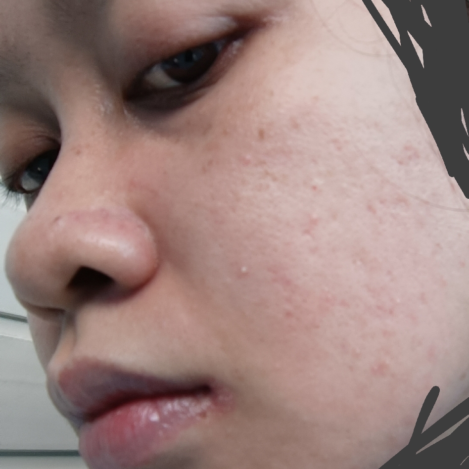 5X Ceramide Barrier Repair Moisture Gel Moisturizer imgfdn-ba5d912e-ad19-46c6-88d0-7711cb11f4ba